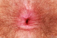 ATK hairy Pearl Sage Set