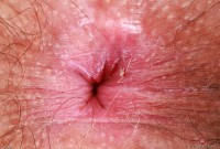 ATK hairy Pearl Sage Set