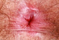 ATK hairy Pearl Sage Set