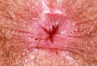 ATK hairy Pearl Sage Set