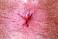 ATK hairy Pearl Sage Set