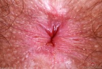 ATK hairy Pearl Sage Set