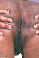 ATK hairy  in exotic and hairy