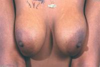 ATK hairy  in exotic and hairy