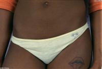 ATK hairy  in exotic and hairy