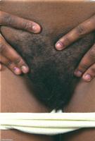 ATK hairy  in exotic and hairy