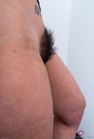 ATK hairy  in young and hairy