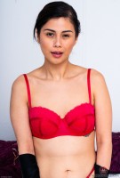 ATK hairy  in young and hairy