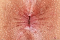 ATK hairy Penelope Reed Set