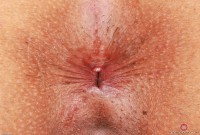 ATK hairy Penelope Reed Set