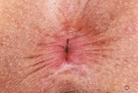 ATK hairy Penelope Reed Set