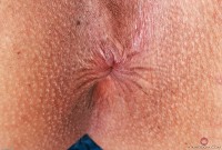 ATK hairy Penelope Reed Set