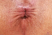 ATK hairy Penelope Reed Set