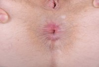 ATK hairy  in young and hairy