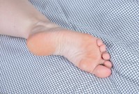 ATK hairy  in mature and hairy