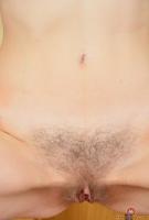 ATK hairy  in mature and hairy