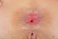 ATK hairy Mischelle Set