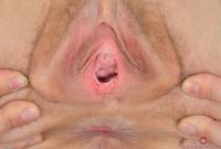 ATK hairy Mischelle Set