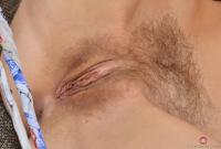 ATK hairy  in mature and hairy