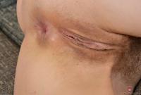 ATK hairy Mischelle Set