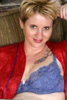ATK hairy  in mature and hairy