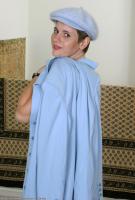 ATK hairy  in mature and hairy