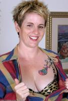 ATK hairy  in mature and hairy