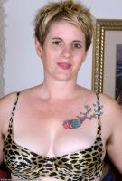 ATK hairy  in mature and hairy