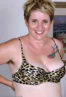 ATK hairy  in mature and hairy