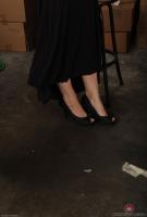 ATK hairy  in mature and hairy