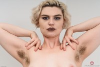 ATK hairy  in young and hairy