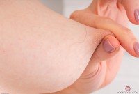 ATK hairy  in young and hairy