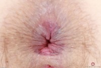 ATK hairy Quinn Helix in young and hairy