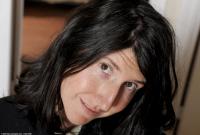 ATK hairy  in mature and hairy