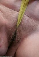 ATK hairy  in mature and hairy