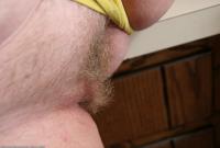 ATK hairy  in mature and hairy