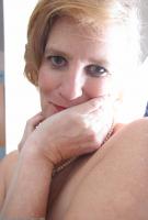 ATK hairy  in mature and hairy