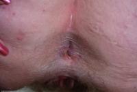 ATK hairy Raylynn Set