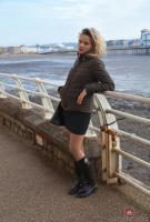 ATK hairy  in young and hairy