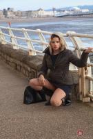 ATK hairy  in young and hairy