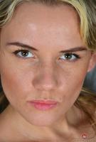 ATK hairy  in mature and hairy