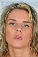 ATK hairy  in young and hairy