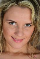 ATK hairy  in young and hairy