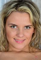 ATK hairy  in young and hairy