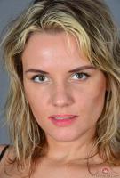 ATK hairy  in young and hairy