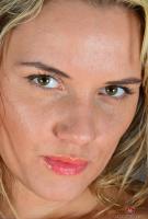 ATK hairy  in young and hairy