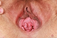 ATK hairy Remi Ferdinand Set