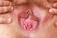 ATK hairy Remi Ferdinand Set