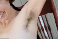 ATK hairy Renee Set