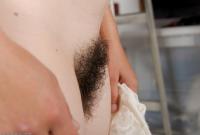 ATK hairy  in mature and hairy